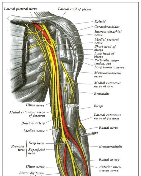 radial nerve dysfunction radial nerve dysfunction   problem