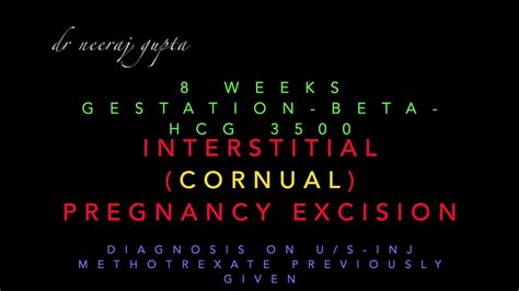 interstitialcornual pregnancyectopic cornuostomycornual excision