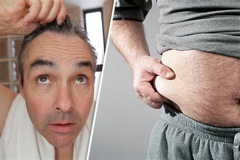 Balding Weight Gain And Low Sex Drive Seven Signs You