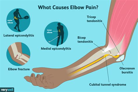 elbow pain  treatment      healthcare provider