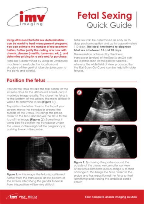 Fetal Sexing Quick Guide Imv Imaging