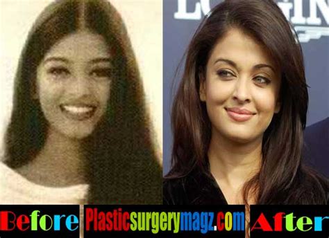 Aishwarya Rai Plastic Surgery Before And After Picture