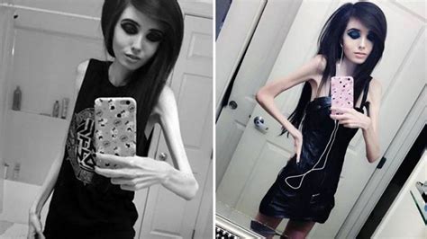 Thousands Want Worryingly Thin Youtuber Banned Amid Claims She Promotes