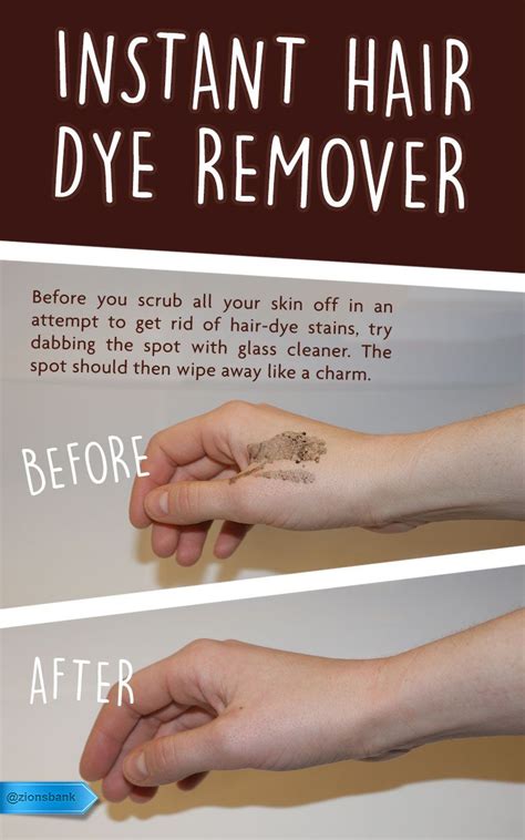 How Do You Remove Dye Stains From Skin Howotremvo