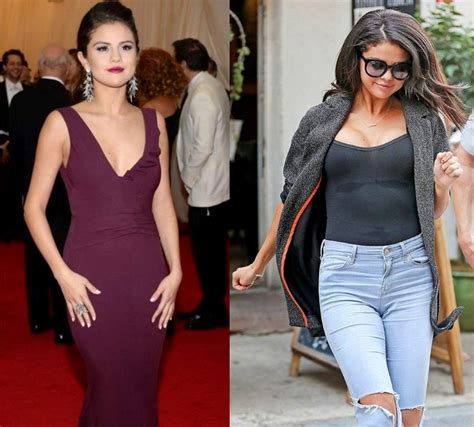 Selena Gomez Plastic Surgery For Older Looks