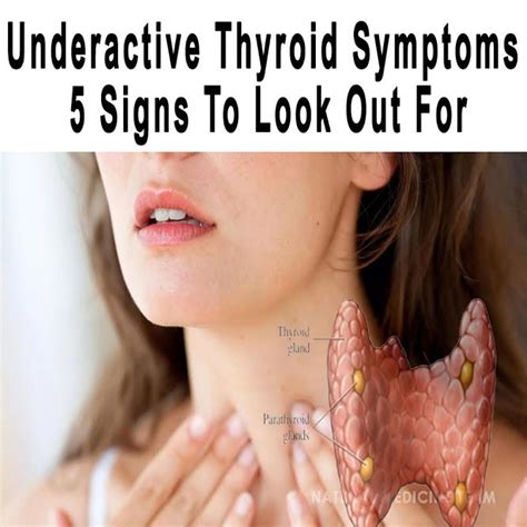 underactive thyroid symptoms  signs