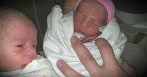 mom gives birth to rare mono twins without knowing she was pregnant