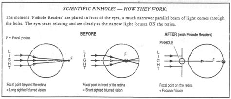 pinhole glasses can you improve your eyesight with