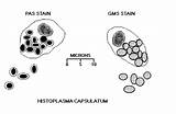 Histoplasma Capsulatum Morphology Gms Aids sketch template