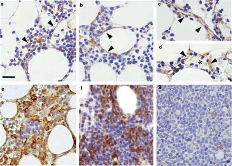 Cxcl12 Stromal Cells As Bone Marrow Niche For Cd34 Hematopoietic