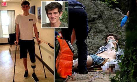 Teen Whose Foot Was Blown Off By Explosive In Central Park