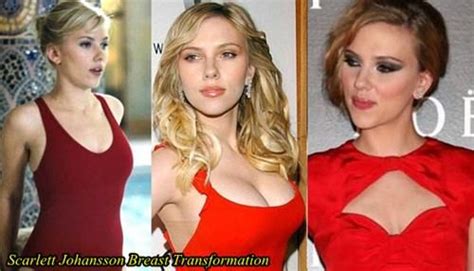 pin by jessie holliday on just a thought plastic surgery breast rhinoplasty