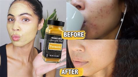 proof  turmeric  acne works      man health magazine onlinecom