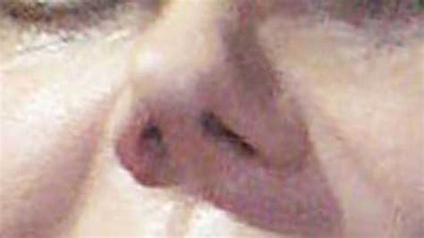 guess whose button nose this is