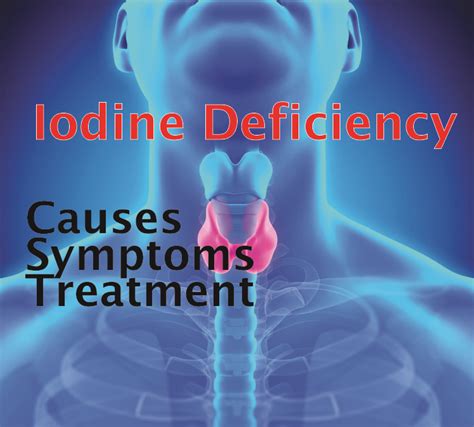 iodine deficiency disorder  man  symptoms treatment