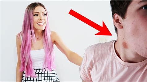 Cheating Hickey Prank On Girlfriend Almost Backfires Youtube