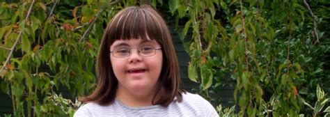 down syndrome girl preteen