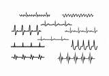 Rhythm Heartbeat Rhythmus Herz Vektor Sammlung Uidownload Vecteezy Relevant Vectorified sketch template