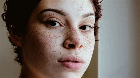 freckle on nose meaning freckle on nose meaning