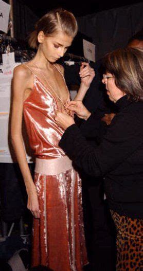 11 Best Anorexic Bulimic Celebrity Images On Pinterest