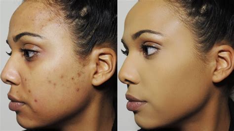 rid  dark spots  face   creams home remedies