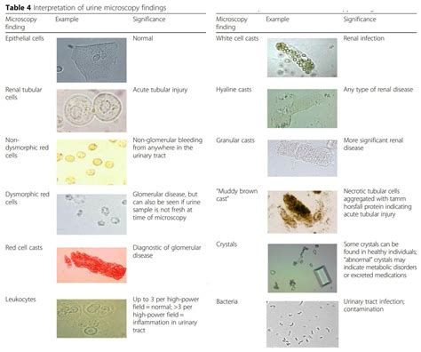 atlas  urine microscopy findings epithelial cells microscopy