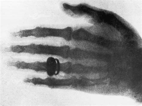 the first x ray photograph rhodri marsden s interesting objects no 86