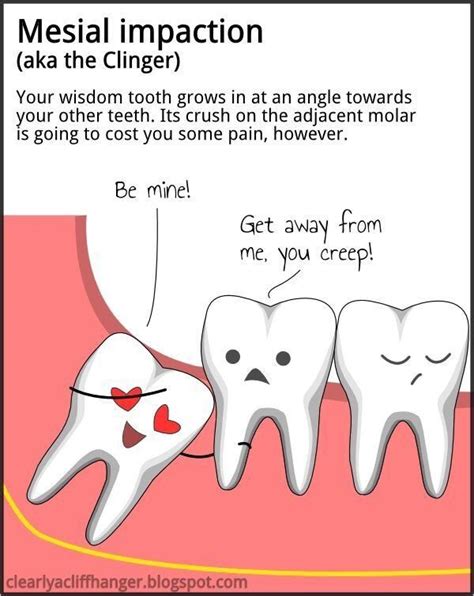 Wisdom Teeth Humor Dental Jokes Wisdom Teeth Dental Fun