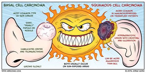 basal cell carcinoma  squamous cell carcinoma medcomic