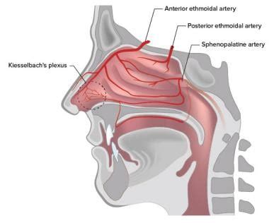 anterior nasal packing  epistaxis overview technique preparation