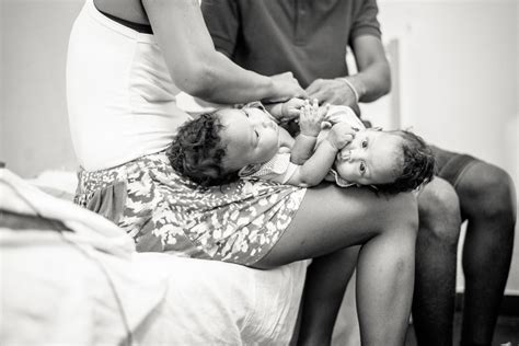 photographer captures the beauty of conjoined twins