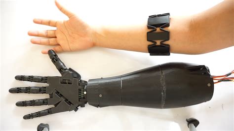 3d Printed Myoelectric Hand Prosthesis The Ieee Maker Project