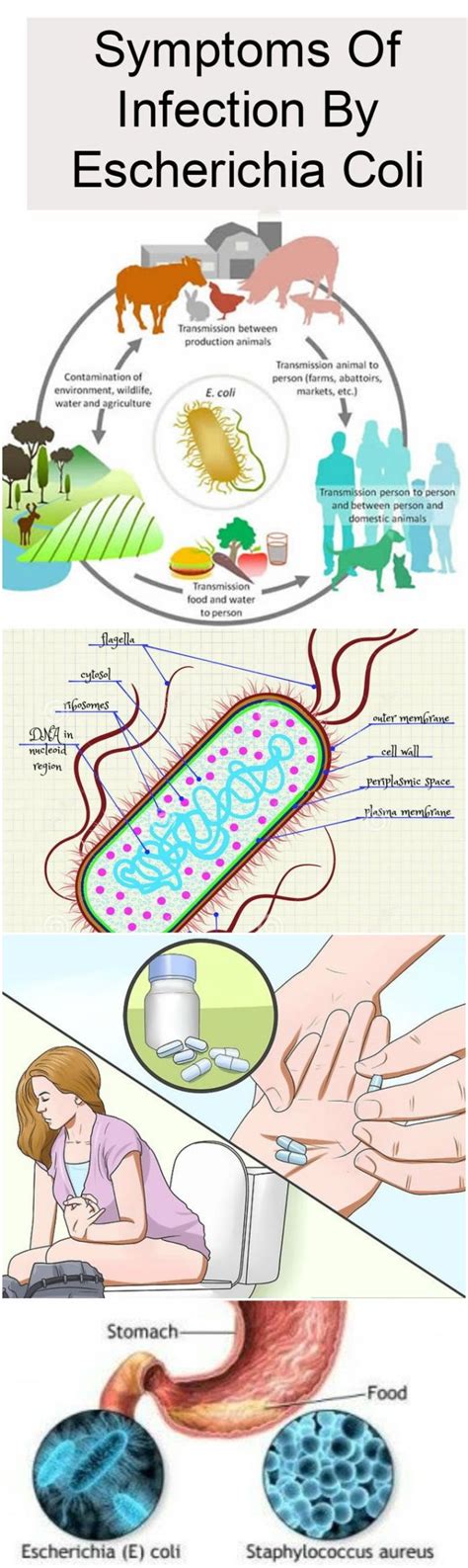 Educational Symptoms Of Infection By Escherichia Coli