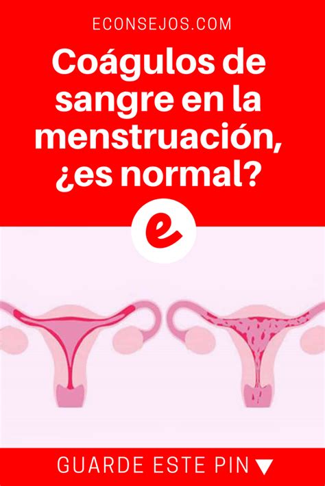Coágulos De Sangre En La Menstruación ¿es Normal