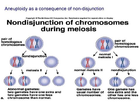 Chromosome Karyotype And Numerical Chromosomal Abnormalities Dr