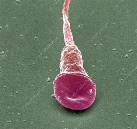 Human Sperm Cell Sem Stock Image P624 0137 Science
