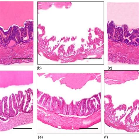 A F Histopathology Of Seminal Vesicle After Exposure