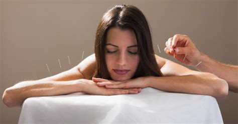 the villages chiropractor legacy clinic reasons to consider dry needling
