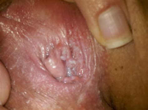 bumps around my vagina hole full screen sexy videos