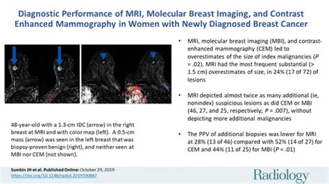 diagnostic performance of mri molecular breast imaging and contrast