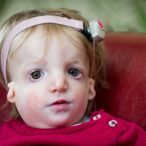 father with facial deformity says of his daughter with the same condition i ll tell her she s