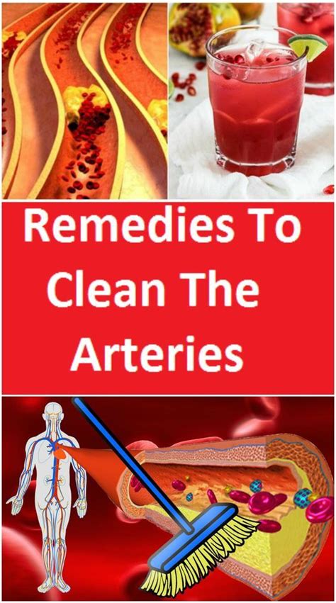 remedies  clean  arteries remedies healthy advice arteries