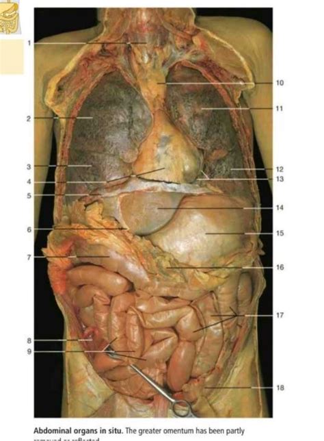 cadaver images week  thoracic cavity  abdominal diagram quizlet