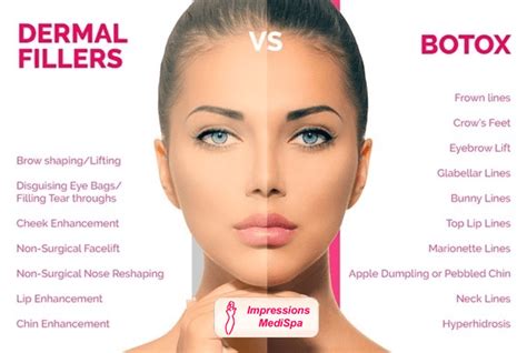 difference between botox and dermal fillers impressions medispa