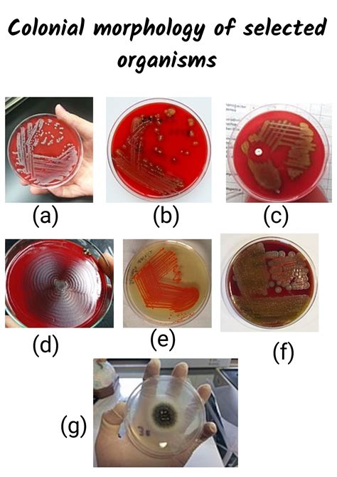 colony morphology examples