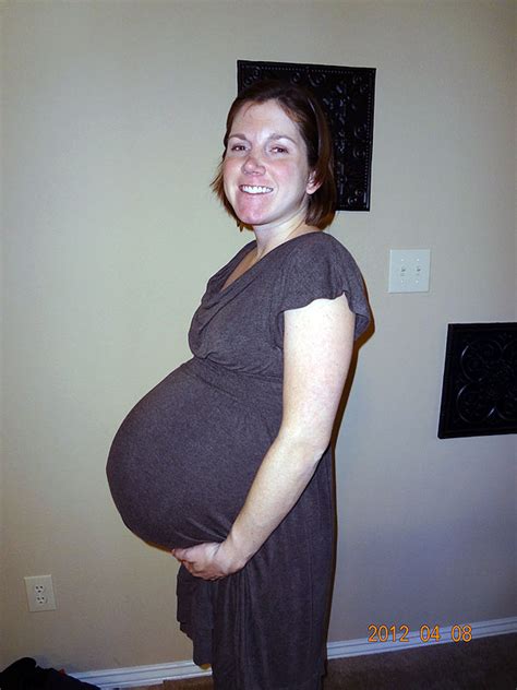 Pregnant Women With Sextuplets