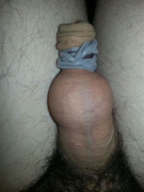 tied foreskin pissing photo album by kinky slave