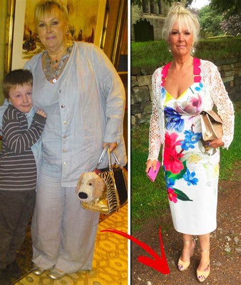 Weight Loss Mother Loses Six Stone After Bleeding Behind The Eye