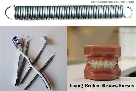 broken braces forsus spring   fix     orthodontic braces care