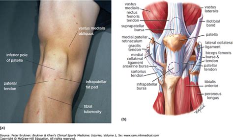 Anterior Knee Pain Brukner And Khan’s Clinical Sports